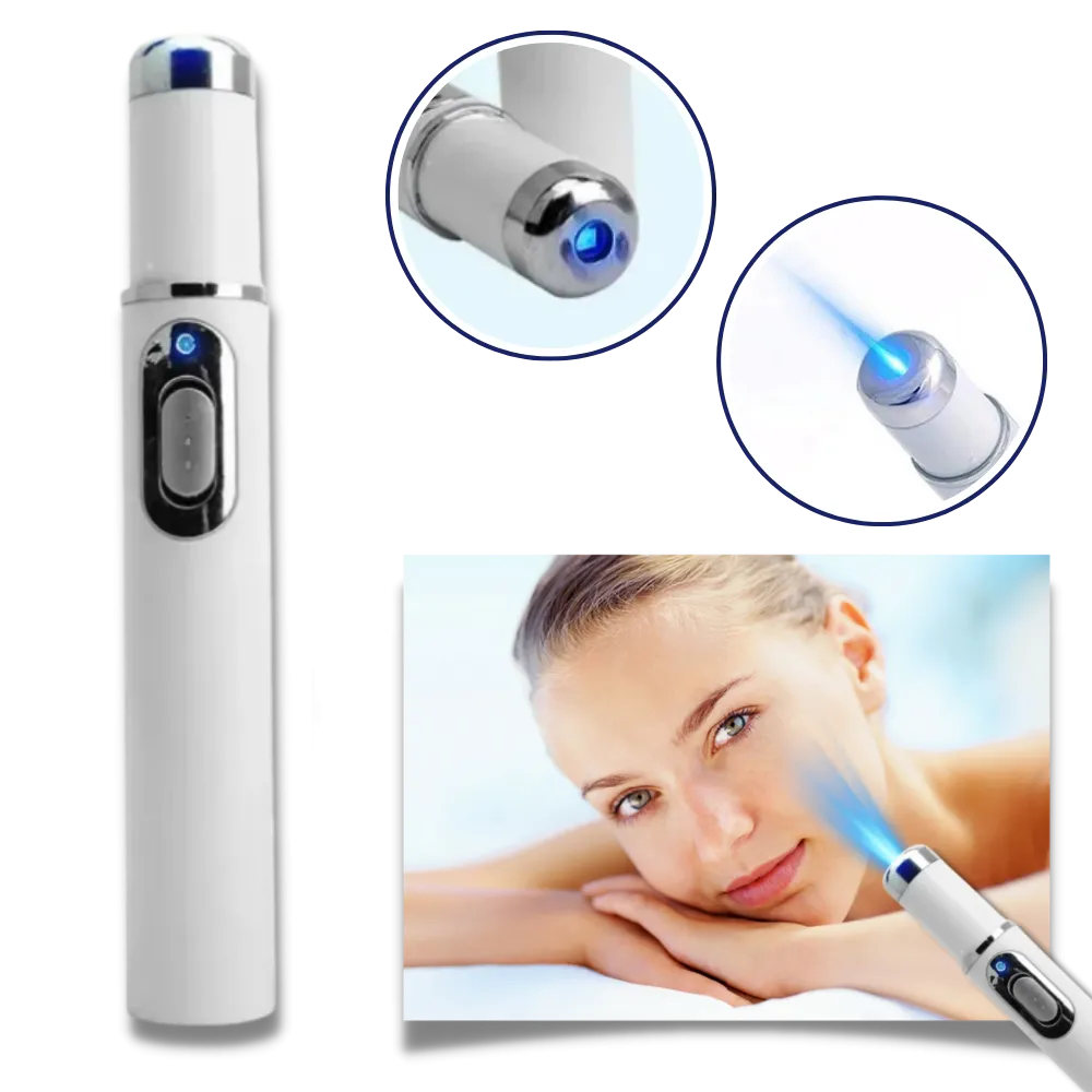 Dark Spot Remover Blue Laser Pen
